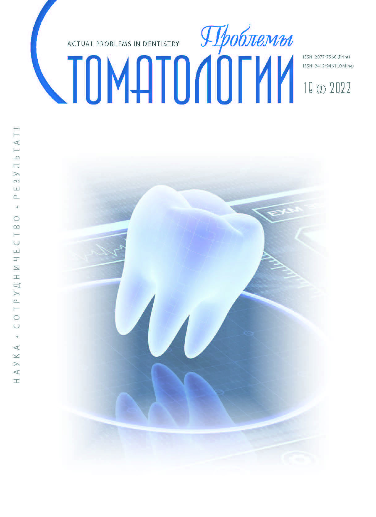                         COMPARISON OF CONE BEAM COMPUTED TOMOGRAPHY DATA IN PATIENTS WITH INTRAARTICULAR PATHOLOGY OF THE TEMPOROMANDIBULAR JOINT WITH THE PRESENCE AND ABSENCE OF FACIAL ASYMMETRY
            